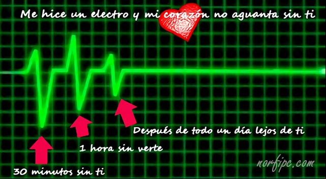 Me hice un electrocardiograma y dice el medico que mi corazón, sin ti no aguanta Imagen del examen del corazon de un enamorado
